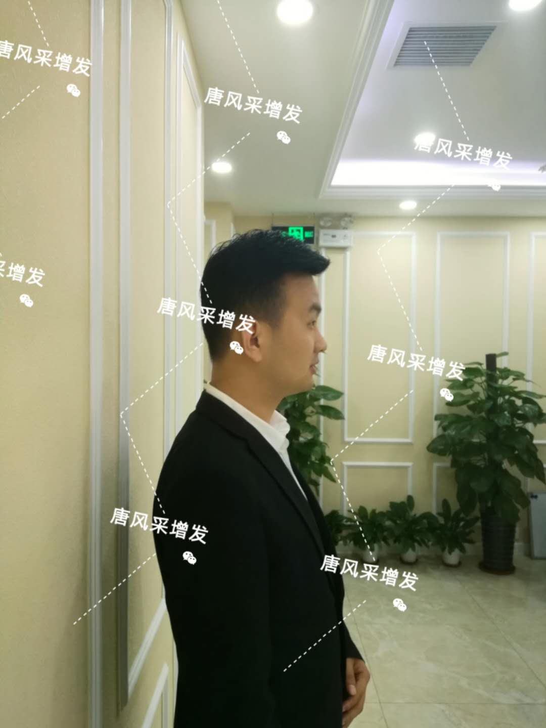 輸了頭發(fā)不能輸氣質(zhì)，看帥哥的逆襲之路！