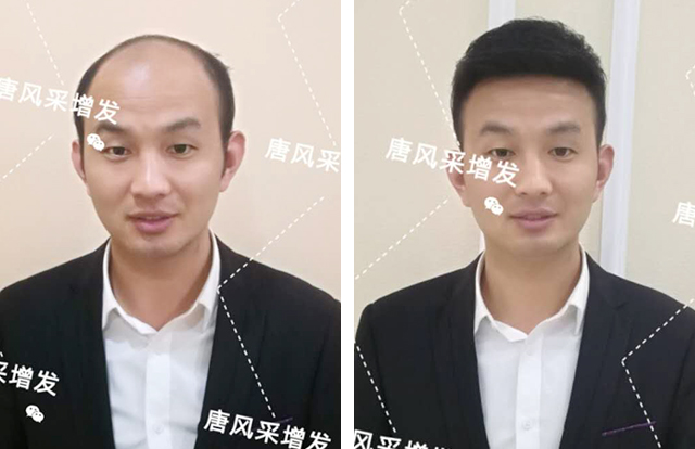 輸了頭發(fā)不能輸氣質(zhì)，看帥哥的逆襲之路！