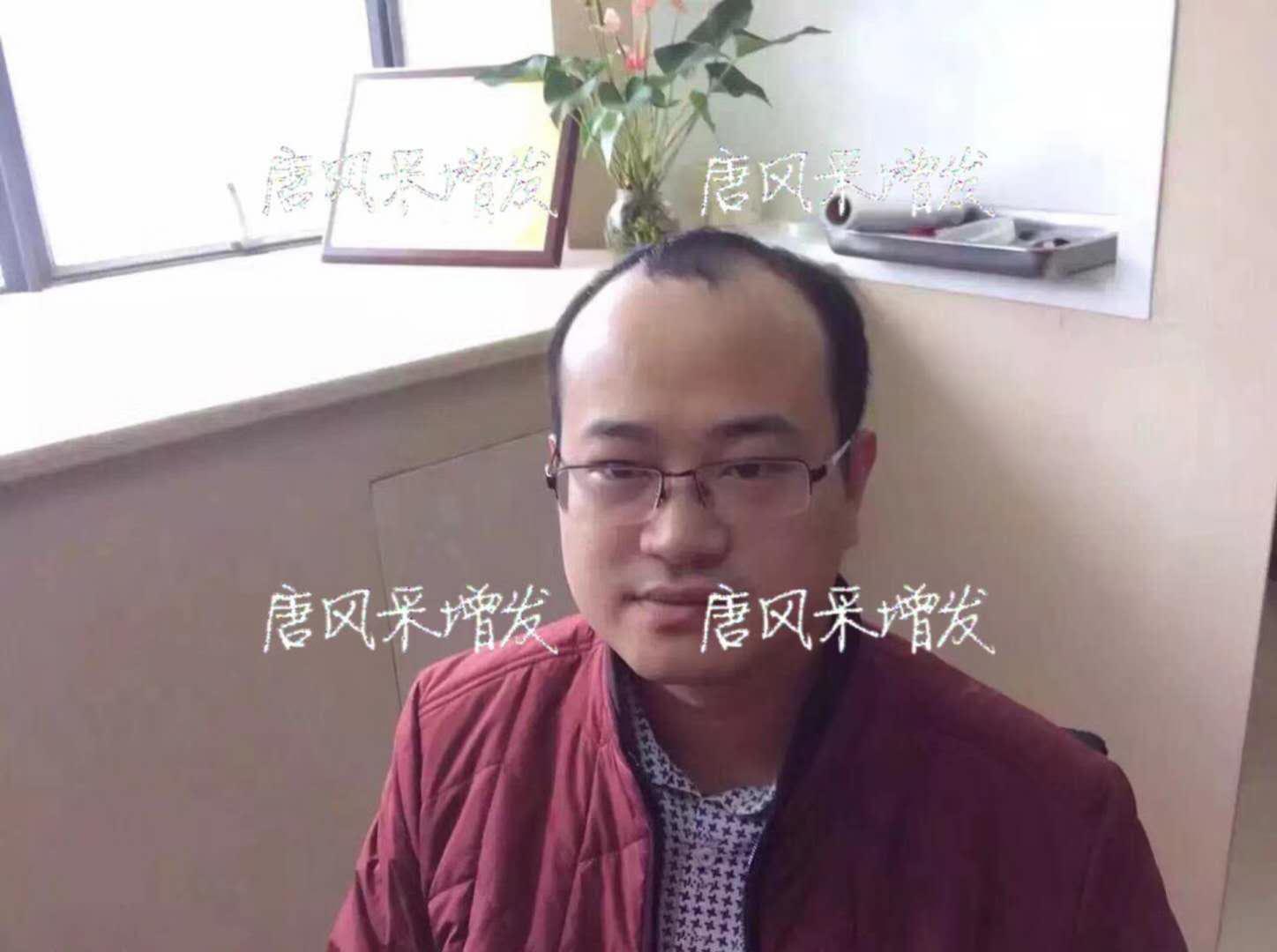  生發(fā)了這么久，但凡有效果的也該有些跡象了