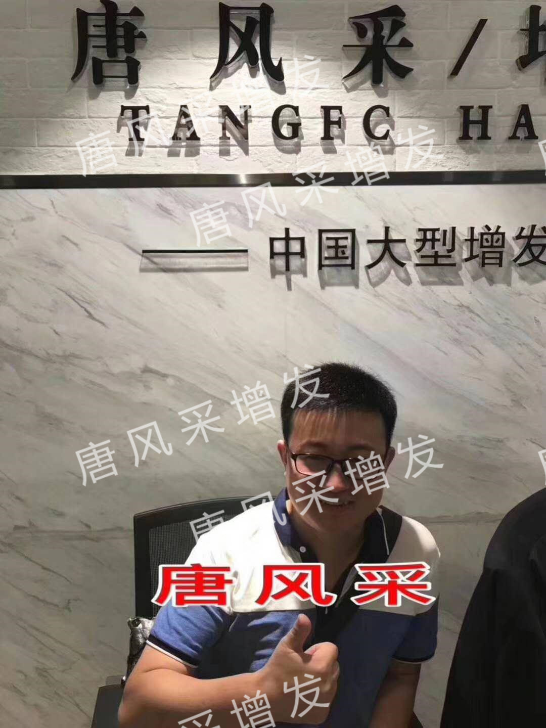 貧窮限制了想象，禿頂限制了造型？