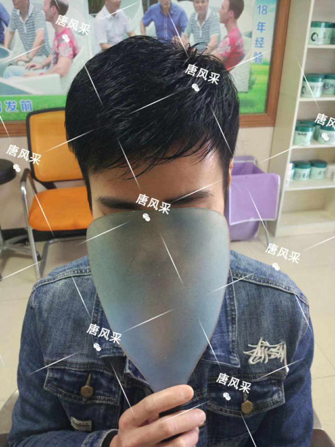 脫發(fā)謝頂壓力大，增發(fā)補發(fā)一身輕！