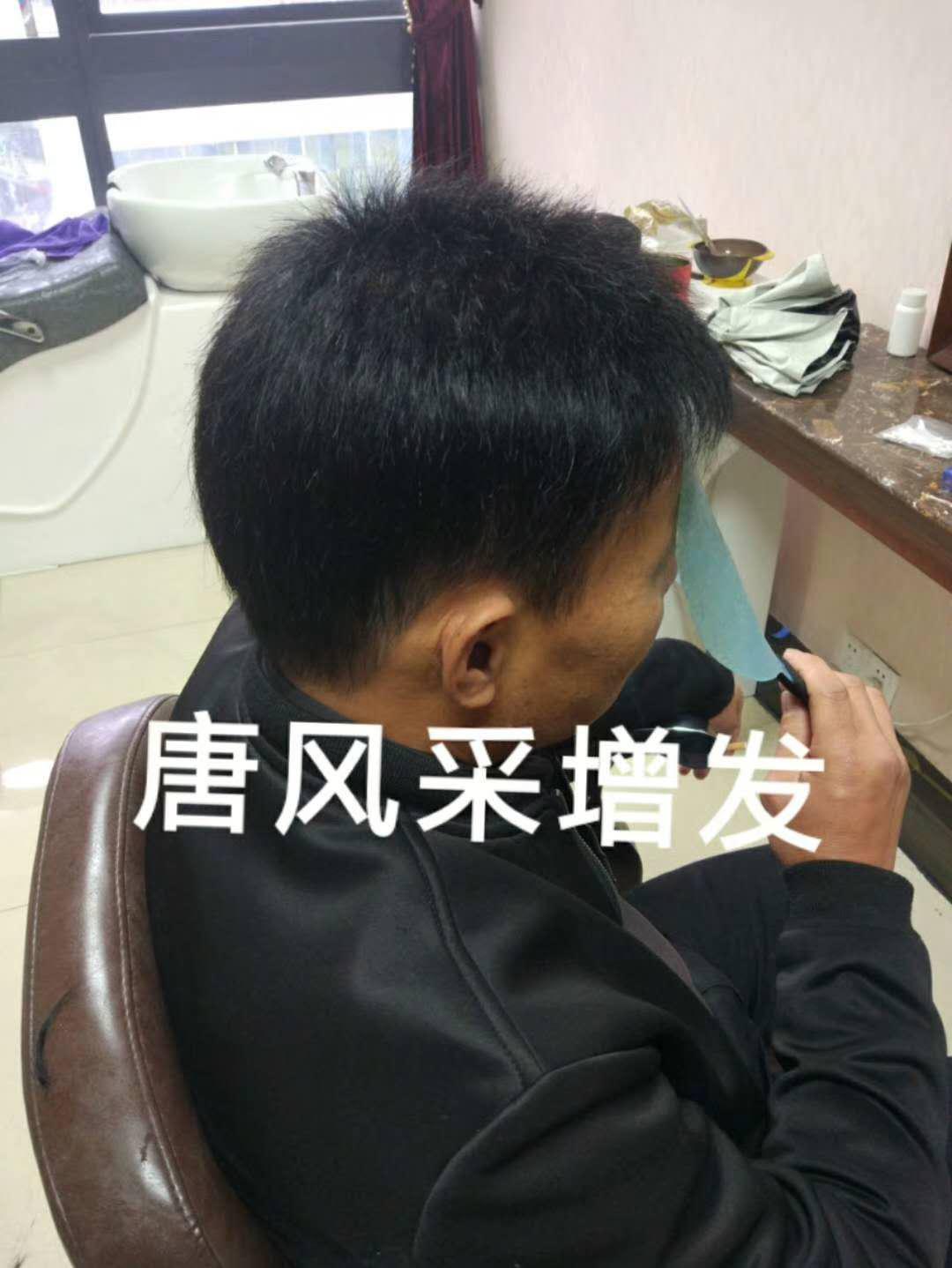 脫發(fā)謝頂壓力大，增發(fā)補發(fā)一身輕！