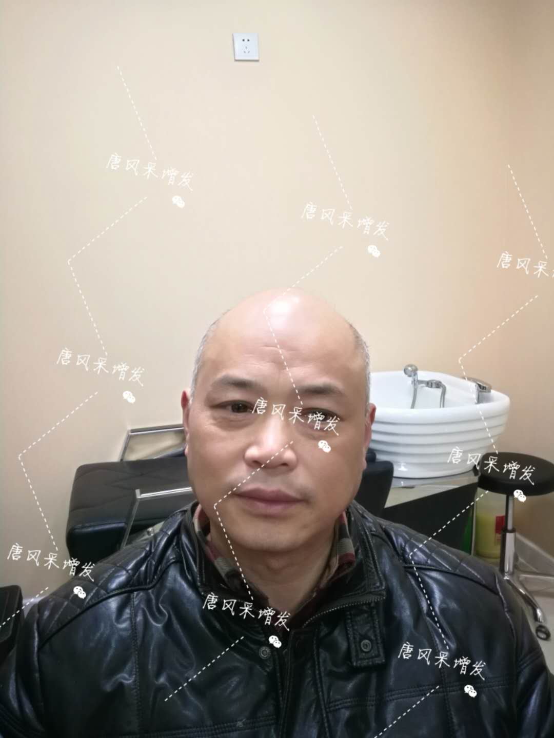 我的天吶！沒(méi)想到某防脫洗發(fā)水的老板居然也脫發(fā)了！