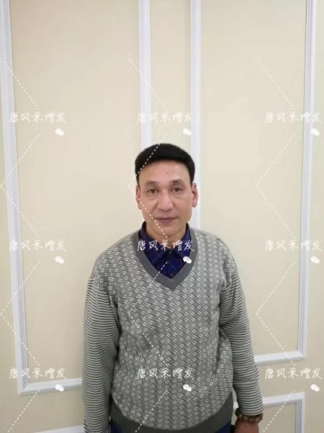 我的天吶！沒(méi)想到某防脫洗發(fā)水的老板居然也脫發(fā)了！