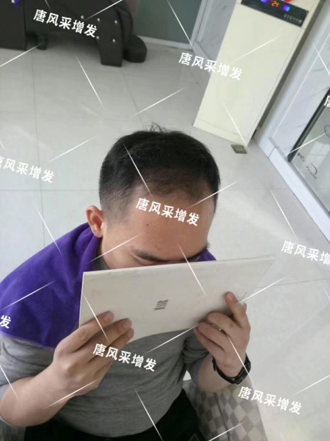 感覺自尊心好受打擊，朋友說我“頭上的油都夠炒盤菜了...
