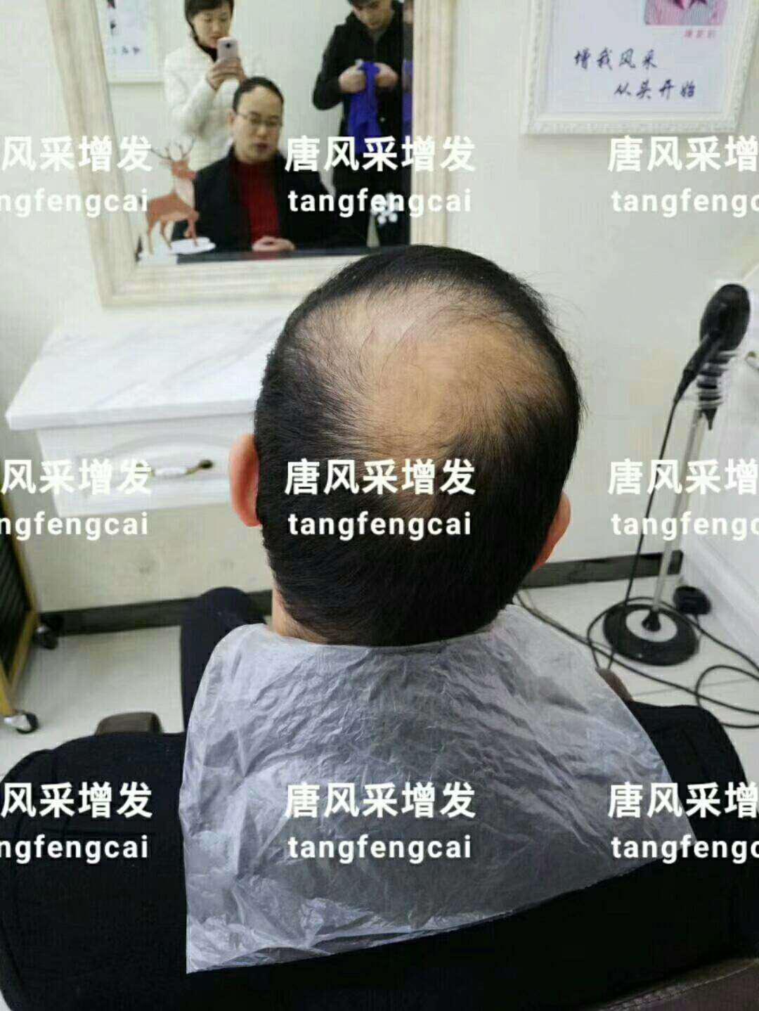  一轉(zhuǎn)眼年輕十歲，你差的就是這點(diǎn)點(diǎn)頭發(fā)！
