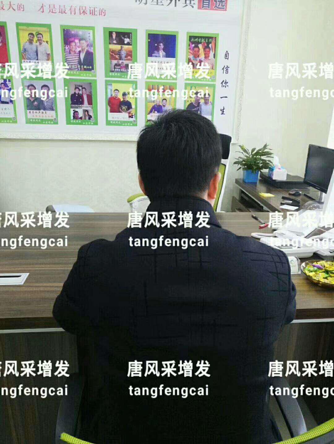 一轉(zhuǎn)眼年輕十歲，你差的就是這點(diǎn)點(diǎn)頭發(fā)！