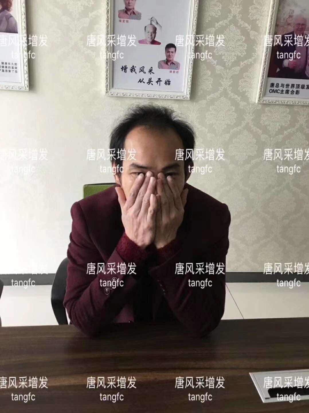 一轉(zhuǎn)眼年輕十歲，你差的就是這點(diǎn)點(diǎn)頭發(fā)！
