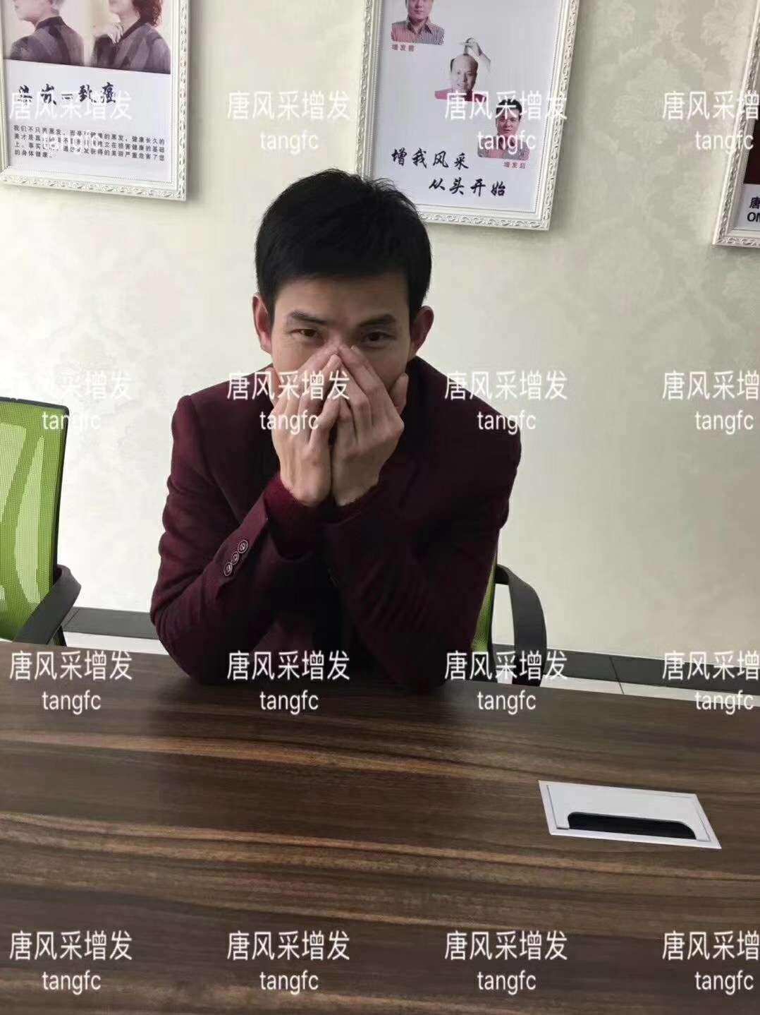  一轉(zhuǎn)眼年輕十歲，你差的就是這點(diǎn)點(diǎn)頭發(fā)！