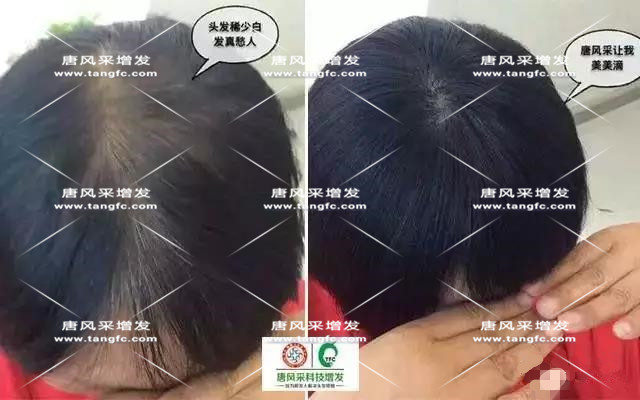 女士假發(fā)見(jiàn)證華麗轉(zhuǎn)變，前后差別震撼！