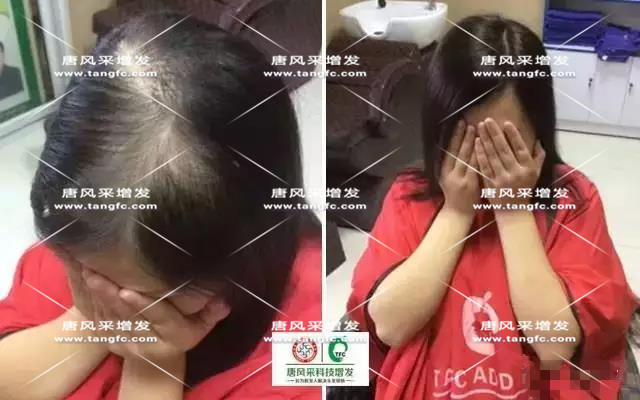 女士假發(fā)見(jiàn)證華麗轉(zhuǎn)變，前后差別震撼！