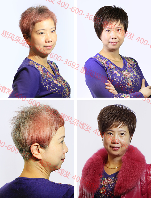 織發(fā)補(bǔ)發(fā)中心 織發(fā)補(bǔ)發(fā)中心:你與幸福生活只差一次體驗(yàn)