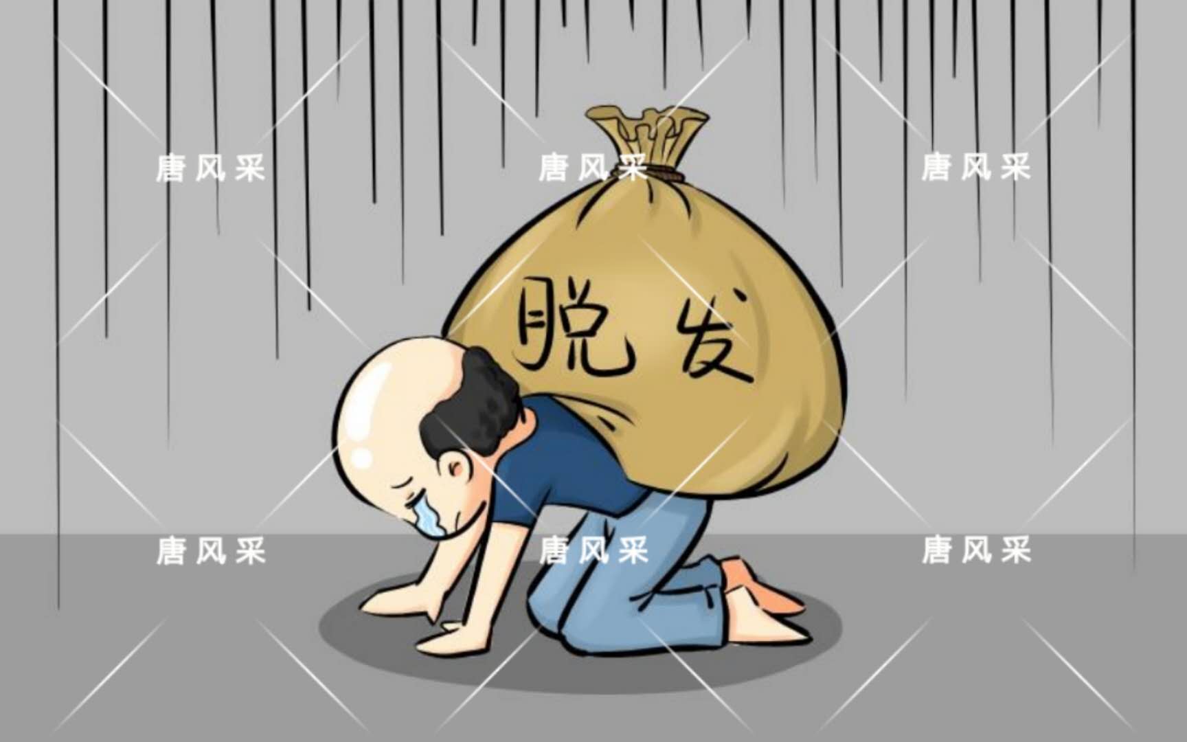 男人脫發(fā)原因多，不能一味怨腎虧！