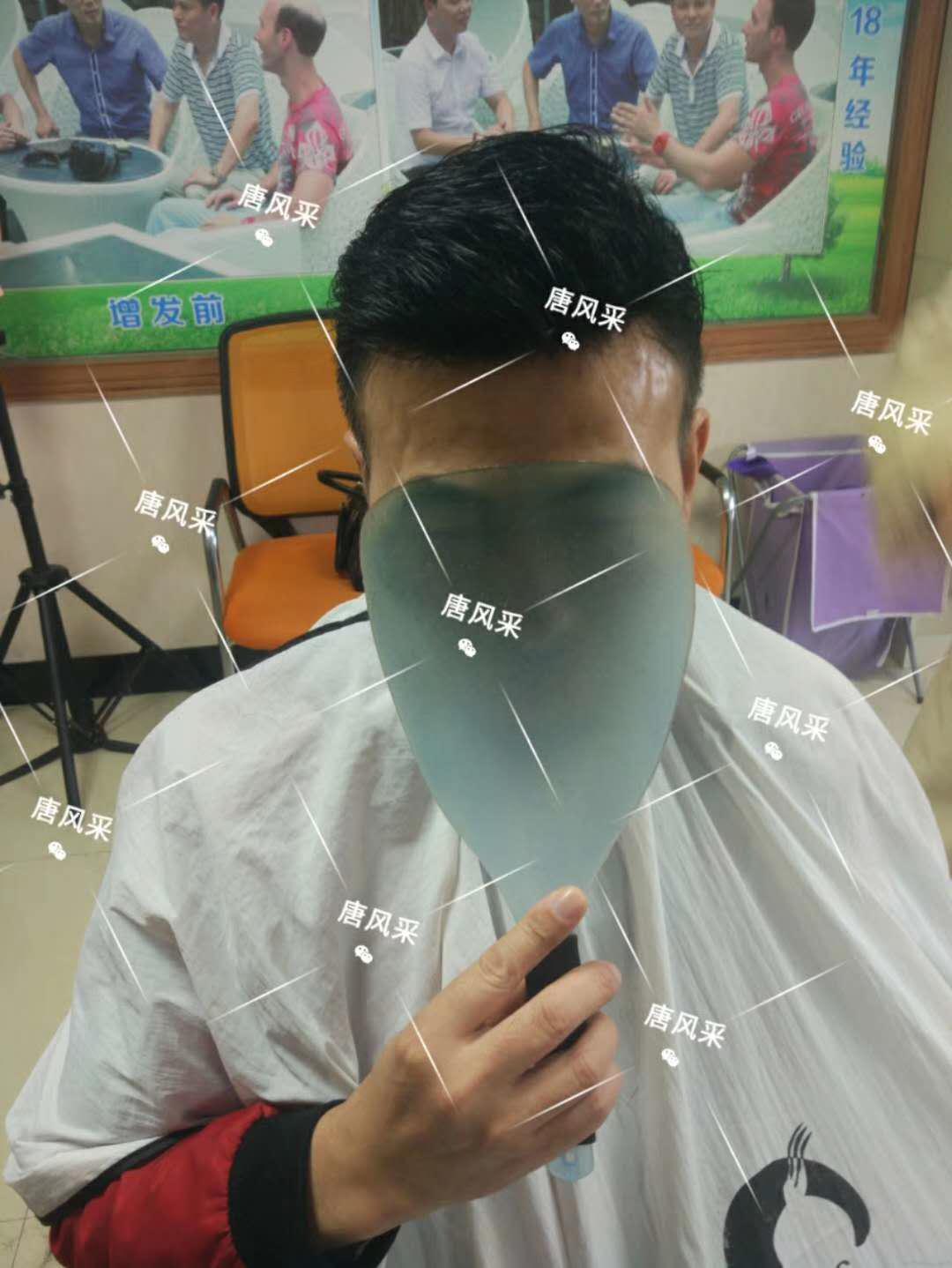 男人脫發(fā)原因多，不能一味怨腎虧！