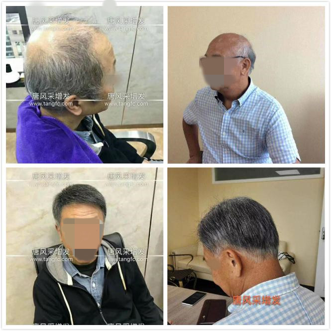 男老人假發(fā)超薄設(shè)計，這樣的逼真效果你絕對沒見過！