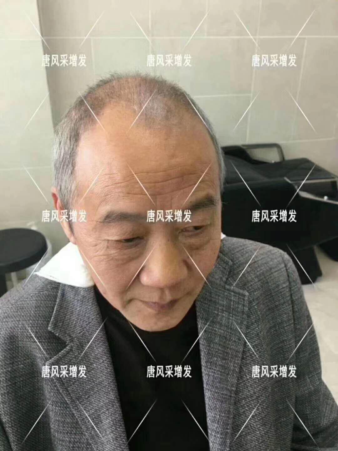 常按這個穴位好處多多 有助睡眠還能減少白頭發(fā)！