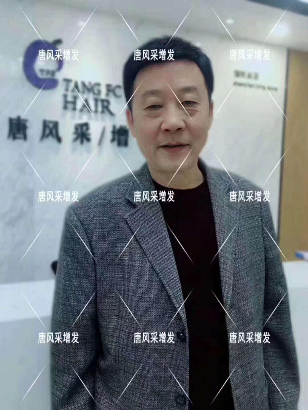 常按這個穴位好處多多 有助睡眠還能減少白頭發(fā)！