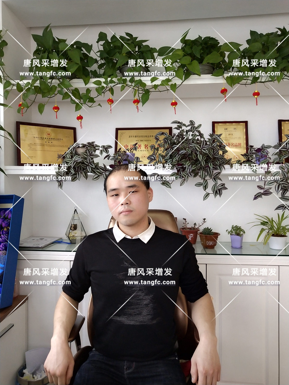 增發(fā)還是植發(fā)，這是個(gè)問(wèn)題！