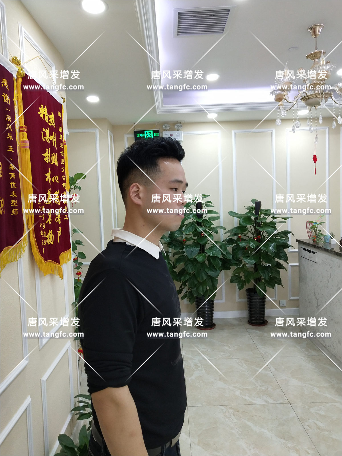 增發(fā)還是植發(fā)，這是個(gè)問(wèn)題！