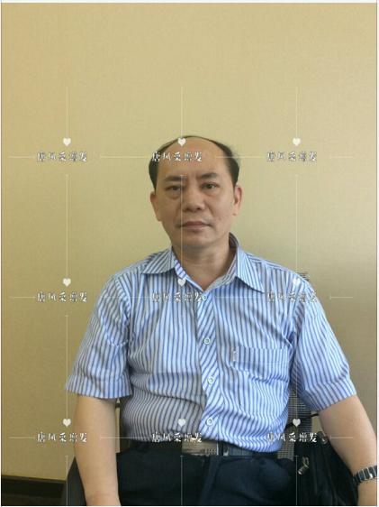 存款重要還是頭發(fā)重要？聽聽李先生怎么說！