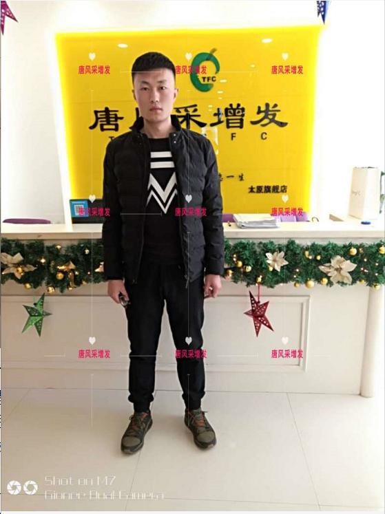 好形象擁抱新生活，唐風(fēng)采助力脫發(fā)新青年！