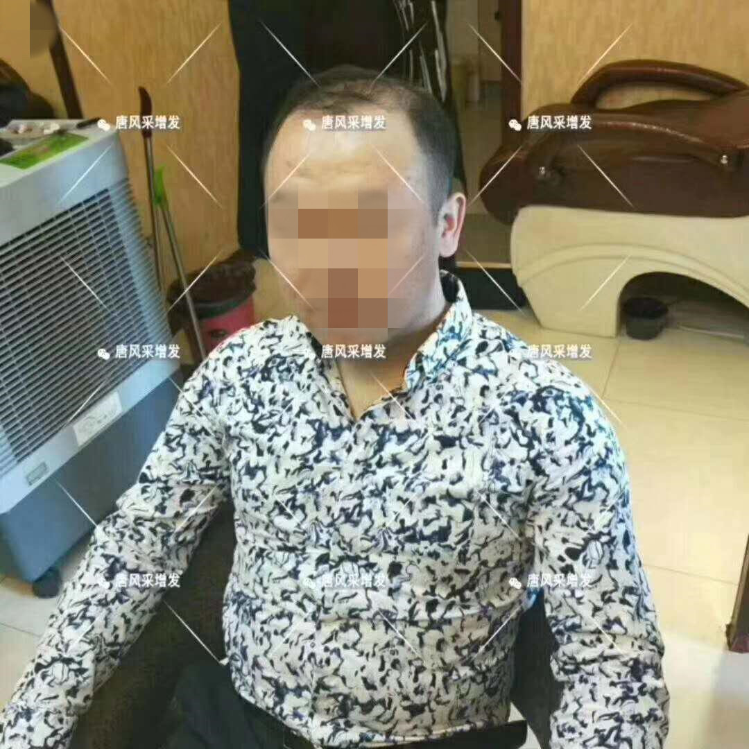 春夏季最新帥氣發(fā)型，頭發(fā)再少也能hold??！