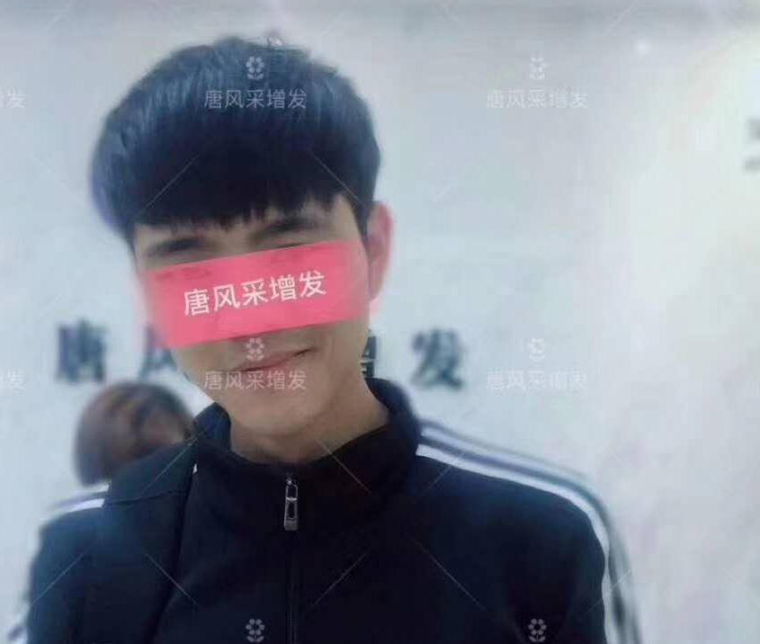 春夏季最新帥氣發(fā)型，頭發(fā)再少也能hold??！