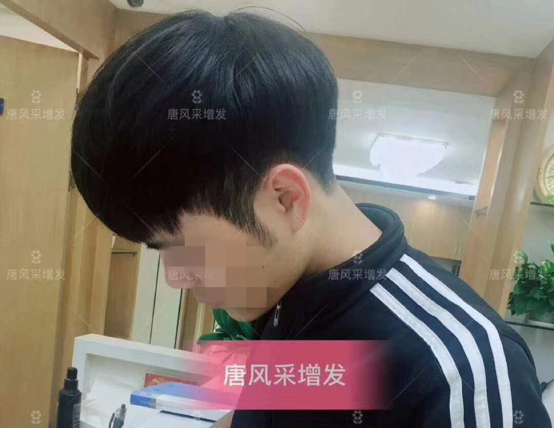 春夏季最新帥氣發(fā)型，頭發(fā)再少也能hold??！