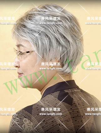嘉興專業(yè)織發(fā)補(bǔ)發(fā)幫助發(fā)友回歸正常生活，笑對(duì)磨難
