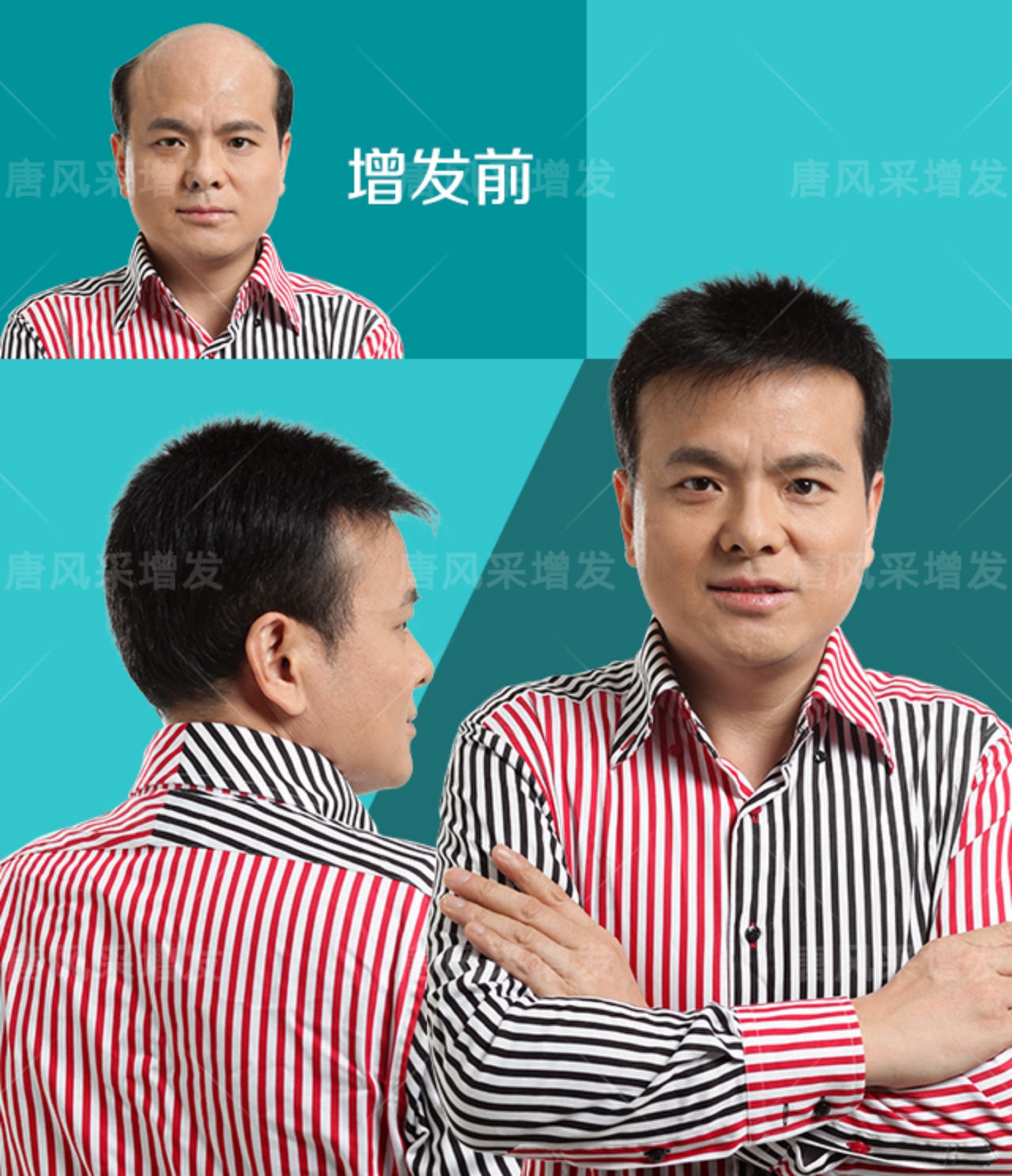 稀發(fā)不哭！終于知道頭發(fā)稀疏可以這樣做！