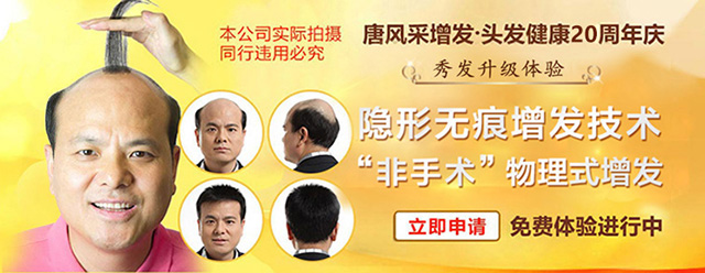 長(zhǎng)沙補(bǔ)發(fā)大概能用多久，什么發(fā)型都可以做嗎？