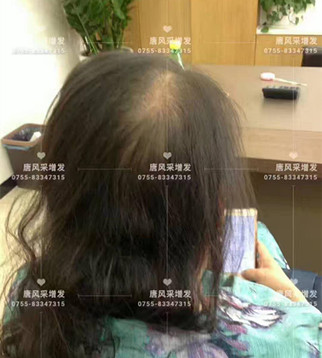 讓頭發(fā)一直好好的，唐風采就是這般任性！