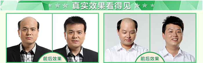 蘭州做假發(fā)，想要方便快捷選擇做假發(fā)！
