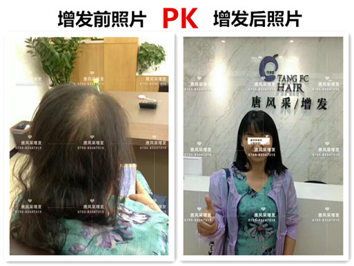 頭發(fā)稀少也能擁有一頭好發(fā)型，不信請(qǐng)看！