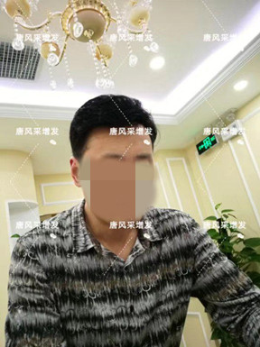 嘉興買隱形假發(fā)哪家好？很多人選擇嗎？