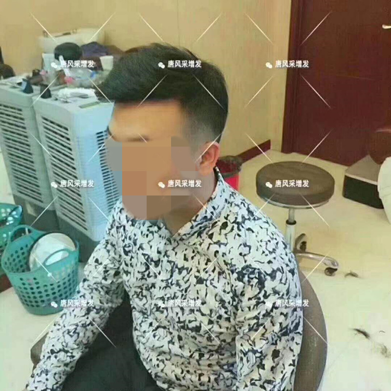 臺(tái)州真發(fā)假發(fā)哪有賣(mài)，夏天戴假發(fā)會(huì)悶熱嗎？