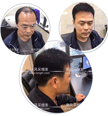 如何避免成為一個(gè)脫發(fā)的中年猥瑣男人？