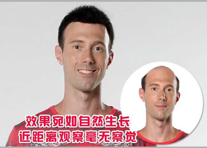 男士假發(fā)套價格貴嗎？買多少錢的效果看起來才逼真？