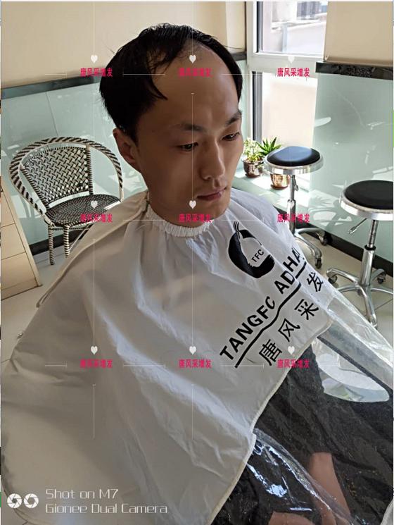 男士假發(fā)套價格貴嗎？買多少錢的效果看起來才逼真？