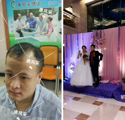 我還沒有脫單，怎么就脫發(fā)了呢?