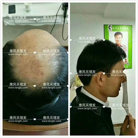 男款假發(fā)品牌哪家好，有用過唐風(fēng)采的嗎？