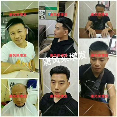 男款假發(fā)品牌哪家好，有用過唐風(fēng)采的嗎？