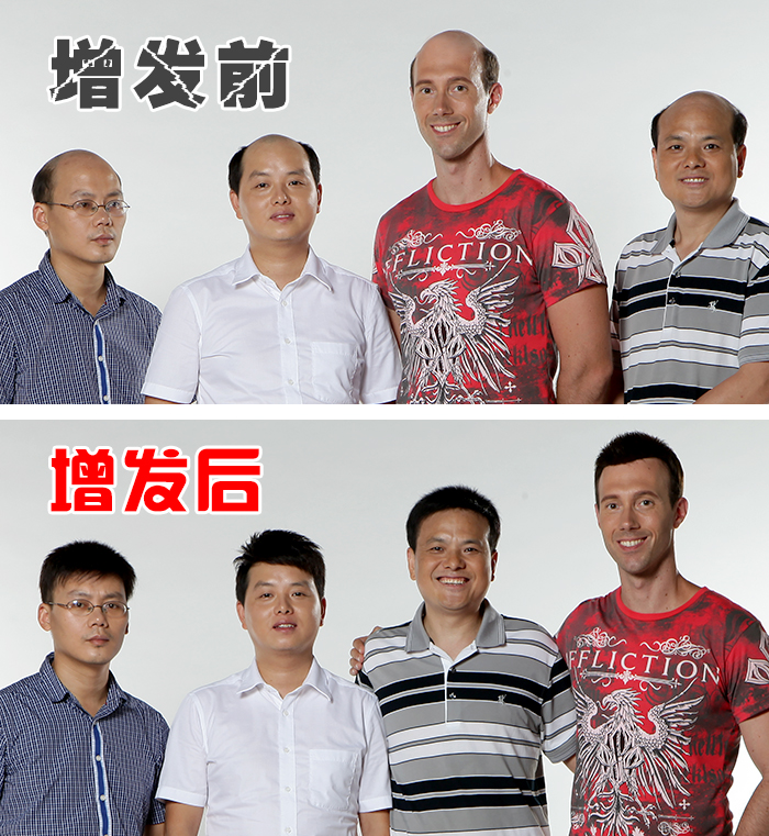臺(tái)州賣(mài)假發(fā)的地方，有高檔真發(fā)假發(fā)賣(mài)嗎？