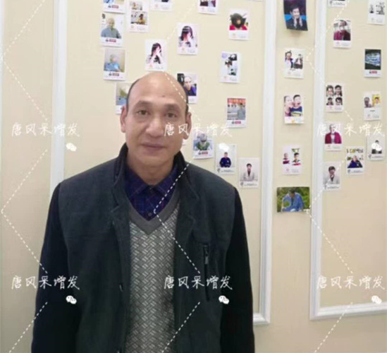 《我不是藥神》火了，山爭哥哥光頭變“藥神”成熱門話題！