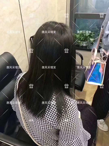 西寧織發(fā)補(bǔ)發(fā)需要多少錢,哪家補(bǔ)發(fā)技術(shù)好？