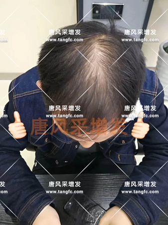 臺(tái)州哪里有賣假發(fā)的，逼真效果怎么樣？