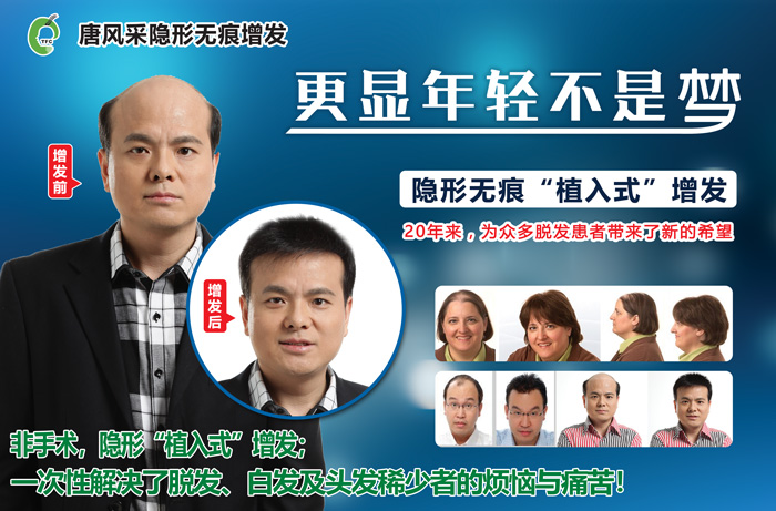 嘉興織發(fā)補(bǔ)發(fā)哪家好？發(fā)友們都“發(fā)”現(xiàn)了這家！