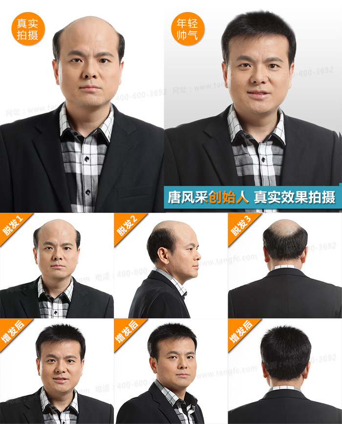 西寧織發(fā)哪里效果最好？近九成發(fā)友都選這家！