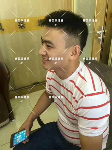 西寧織發(fā)補發(fā)哪家好，真的能改變我的脫發(fā)形象嗎？ 