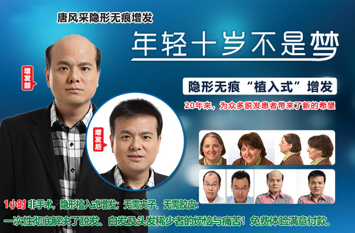 嘉興假發(fā)片定制哪家好？唐風采增發(fā)成了首選！